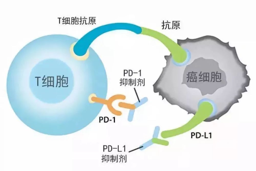 海南pd一1最新消息：海南pd-1进展速递